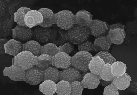 Aspergillus Konidien